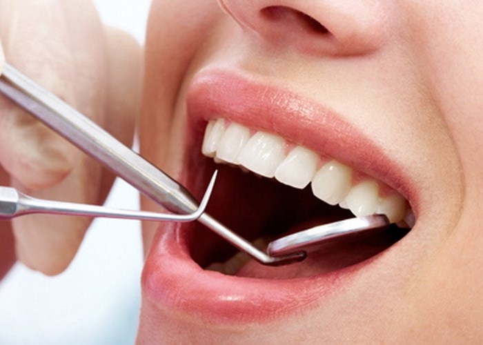 Quand faut-il choisir les implants dentaires ?